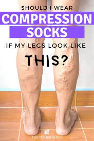 Should I Wear Compression Socks At Work Compression Socks Compression Compression Socks Benefits