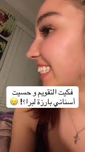 هل أسنانك بارزة بعد فك التقويم؟ إليك الحل!