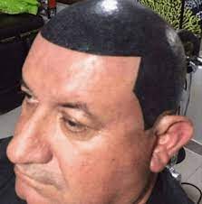 Tattoo under hairline comes to the rescue! Insanely Awful Hair Tattoo Fails Tattoo Ideas Artists And Models