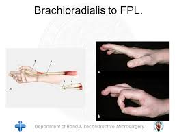Write down your aol username id, your password, your answer to the security question and keep it in a safe and secure place. Department Of Hand Reconstructive Microsurgery Tendon Transfers For The Hand National Congress Of Indonesian Surgery For Surgery Of The Hand Hipita Ppt Download
