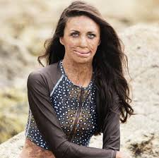 Turia Pitt Survived A Fire That Nearly Took Her Life Five Years Later She S Ready To Compete In The Iron Ironman World Championship Brave Women Amazing Women