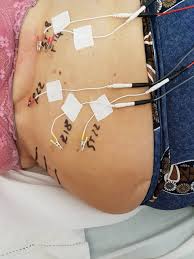 Mature en chaleur baise avec une jeunette !. Dolore Da Neuropatia Post Herpetica