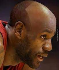 Kaufman sees two reasons why men feel shame about losing their hair. 20 Latest Guy With Bad Hairline Anne In Love