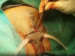 From male to nullo - Dick and balls Surgical removed - ThisVid.com