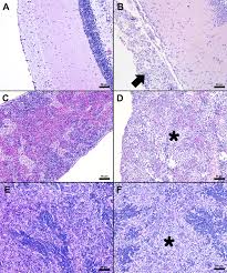 Streptococcus iniae challenge induces minimal acute histopathological  changes in Nile tilapia (Oreochromis niloticus) selectively bred for  disease resistance