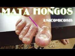 Hongos En Las Uñas De Las Manos Como Eliminarlos Como Eliminar Los Hongos De Las Unas Remedio Casero Unico Micosis Pie De Atleta Y Remedios Caseros Para Hongos En Unas Remedio Para Hongos Hongos En Las Unas