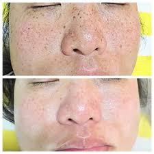 Aesthetic dermatology and thyroid and adrenal health. Zen Aesthetic 69 Photos 87 Reviews Cosmetics Beauty Supply 1600 Post St San Francisco Ca Phone Number Yelp