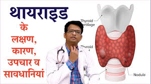 Coronary heart disease is one of the most common diseases and one of the main causes of death, as well as temporary and permanent disability of the population in the developed countries of the world. Thyroid Disease Causes Symptoms Treatment à¤¥ à¤¯à¤° à¤‡à¤¡ à¤• à¤²à¤• à¤·à¤£ à¤• à¤°à¤£ à¤‰à¤ªà¤š à¤° à¤µ à¤¸ à¤µà¤§ à¤¨ à¤¯ Youtube