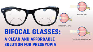 Image result for Presbyopia