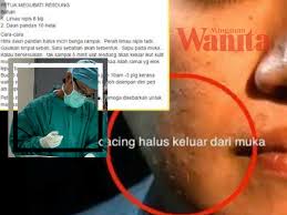 Saya cari punya cari, akhirnya saya jumpa cara paling berkesan nak rawat resdung. Resdung Bukan Sebab Ulat Tapi Sebenarnya Mingguan Wanita