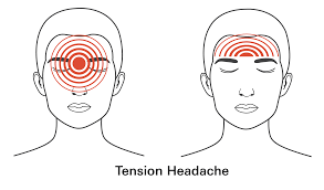 Image result for Headache