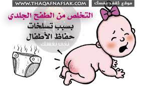 علاج الطفح الجلدي بسبب تسلخات حفاظ الأطفال ثقف نفسك