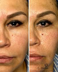 Barbara Galvan Reynoso