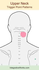 Neck Ache Headache Eye Ache Integrative Works Trigger Points Neck Trigger Points Sore Shoulder
