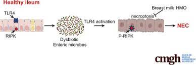 Among screened children, 1641/2169 (75.7%) were screened on time. A Novel Role For Necroptosis In The Pathogenesis Of Necrotizing Enterocolitis Sciencedirect