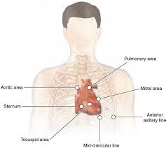 2017 esc guidelines on the diagnosis and treatment of peripheral arterial diseases, in collaboration with the european society for vascular surgery (esvs): Cardiac Auscultation British Journal Of Cardiac Nursing