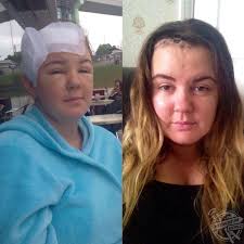 This Woman's Brain Tumour, That Left Her Blind In One Eye, Was Not  Identified By Doctors With One GP Laughing When She Suffered Severe  Migraines