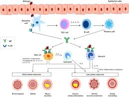 It's a monoclonal antibody, which is a biologic drug that's made from immune system cells. Ige Mediated Multimorbidities In Allergic Asthma And The Potential For Omalizumab Therapy The Journal Of Allergy And Clinical Immunology In Practice