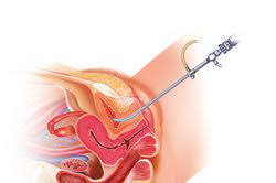 Die Scheide Einer Frau Aufbau Und Funktionen