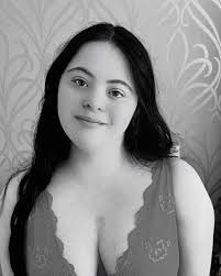 February is Heart ❤️ Awareness Month, a time to raise awareness about heart  health. I'm sharing my story: I had major open-heart surgery at just 5  months old. I nearly never made