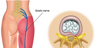 Pin On Health Tips