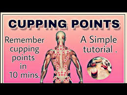 Cupping Points Hijama Points Youtube