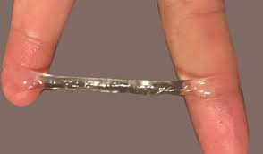 Some types of discharge, however, could signal something more serious. Vaginal Discharge Infection Treatment In Chennai Dr Manu S Gynecology Clinic Chennai Gynecologist