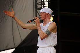 Unfortunately there are no concert dates for yellowman scheduled in 2021. Recalling Yellowman S Journey From An Abandoned Jamaican Albino To The Dancehall Throne Face2face Africa