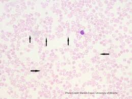Other articles where target cell is discussed: Target Cells Codocytes A Laboratory Guide To Clinical Hematology