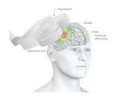 Klinik für psychiatrie, psychotherapie und psychosomatik. Depressionstherapie In Munchen Mit Modernsten Methoden