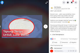 Lakukan masker rambut sekali dalam seminggu untuk menumbuhkan rambut dengan cepat. Cek Fakta Benarkah Tepung Terigu Dapat Mengobati Luka Bakar Cek Faktanya
