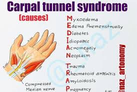 Causes of carpal tunnel syndrome: Carpal Tunnel Syndrome Causes