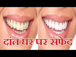 Close the gap for any missing teeth. Whiten Your Yellow Teeth Naturally At Home In Hindi Face Skin Care Beauty Tips For Skin Dry Skin Patches