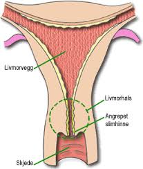 Disse typene er klassifisert i henhold til farge og konsistens. Fakta Om Kreft I Livmoren Nettdoktor