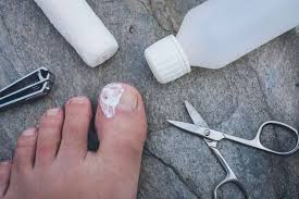 Image result for Toenail Removal