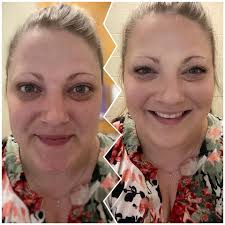 Dermaplaning and working from home today