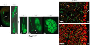 Are Pax proteins potential therapeutic targets in kidney disease and  cancer?