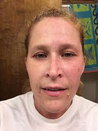 Do any of you sweat profusely