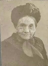 Removing set-in grease stains from laundry?