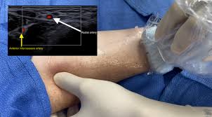 Image result for Allen Test