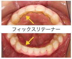 まきの歯列矯正クリニック
