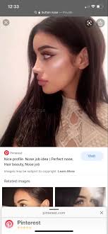 Pin By Sabryna On Nose Job Rhinoplasty Nose Job Perfect Nose