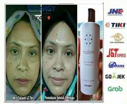 Berikut ini trulum review atau tesmoni penggunaan trulum : Trulum Herbal Alamai Penghilang Gluta Panacea Asli Facebook