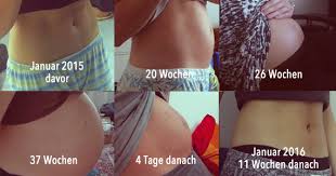 Die schwangerschaft wird dadurch simuliert, dass das gehirn den körper anregt, besonders viel östrogen und gestagen zu produzieren. Mein Bauch Vor Und Nach Der Schwangerschaft