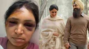 Laal Singh Chaddha Actress Preeti Arora Jain Road Accident Sparks Outrage  and Investigation!