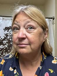 Post Facial Peel & skincare routine! 🩷🔥