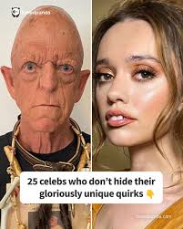 25 celebs who don't hide their gloriously unique quirks (link in the  comments)