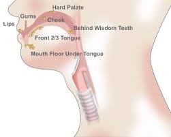 Having an ulcer on the roof of your mouth (also called your hard palate) is a sign of mouth cancer. Lip Oral Cancer Overview Virginia Oncology
