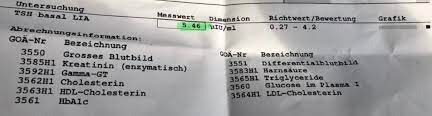 Schilddrusenunterfunktion Und Nun Arzt Doktor Internist