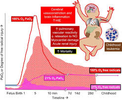Image result for Delayed Transition from Fetal Circulation